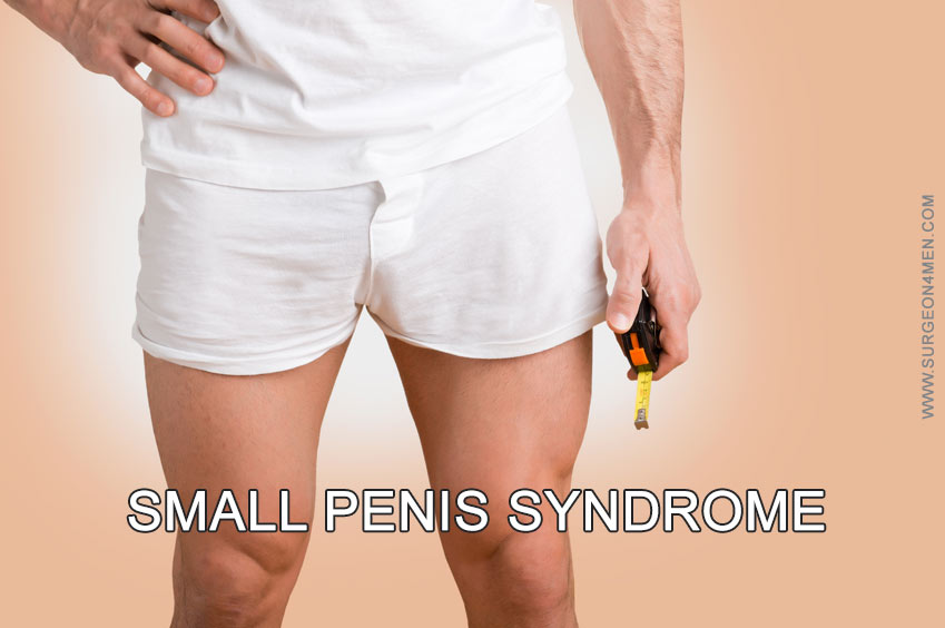 https://www.surgeonformen.com/wp-content/uploads/2015/04/Small-Penis-Syndrome.jpg